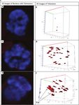Three-Dimensional Telomeric Analysis of Isolated Circulating Tumor Cells (CTCs) Defines CTC Subpopulations1,2 - ScreenCell