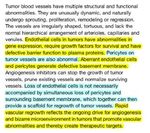 What is angiogenesis? 09/05/2013