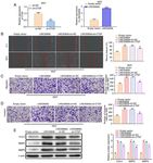 Long non coding RNA 00858 knockdown alleviates bladder cancer via regulation of the miR 3064 5p/CTGF axis