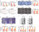 Long non coding RNA 00858 knockdown alleviates bladder cancer via regulation of the miR 3064 5p/CTGF axis