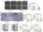 Long non coding RNA 00858 knockdown alleviates bladder cancer via regulation of the miR 3064 5p/CTGF axis