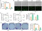 Long non coding RNA 00858 knockdown alleviates bladder cancer via regulation of the miR 3064 5p/CTGF axis