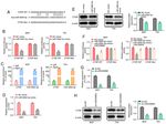 Long non coding RNA 00858 knockdown alleviates bladder cancer via regulation of the miR 3064 5p/CTGF axis