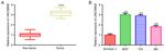 Long non coding RNA 00858 knockdown alleviates bladder cancer via regulation of the miR 3064 5p/CTGF axis