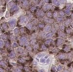 A DLL3-targeted antibody-drug conjugate eradicates high-grade pulmonary neuroendocrine tumor-initiating cells in vivo - Science Translational Medicine