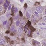A DLL3-targeted antibody-drug conjugate eradicates high-grade pulmonary neuroendocrine tumor-initiating cells in vivo - Science Translational Medicine