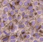 A DLL3-targeted antibody-drug conjugate eradicates high-grade pulmonary neuroendocrine tumor-initiating cells in vivo - Science Translational Medicine