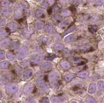 A DLL3-targeted antibody-drug conjugate eradicates high-grade pulmonary neuroendocrine tumor-initiating cells in vivo - Science Translational Medicine