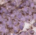 A DLL3-targeted antibody-drug conjugate eradicates high-grade pulmonary neuroendocrine tumor-initiating cells in vivo - Science Translational Medicine