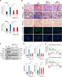 Human pluripotent stem cell-derived alveolar organoids for modeling pulmonary fibrosis and drug testing
