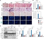 Human pluripotent stem cell-derived alveolar organoids for modeling pulmonary fibrosis and drug testing