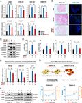 Human pluripotent stem cell-derived alveolar organoids for modeling pulmonary fibrosis and drug testing