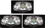 Effects of Mechanical Performance on Deliverability and Dose Distribution by Comparing Multi Institutions' Knowledge-based Models for Prostate ...