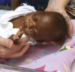 Caring for Vulnerable Babies: The reorganisation of neonatal services in England
