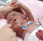 Caring for Vulnerable Babies: The reorganisation of neonatal services in England