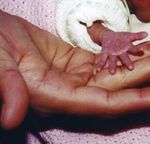 Caring for Vulnerable Babies: The reorganisation of neonatal services in England
