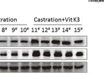 Targeting ADT-Induced Activation of the E3 Ubiquitin Ligase Siah2 to Delay the Occurrence of Castration-Resistant Prostate Cancer