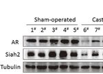 Targeting ADT-Induced Activation of the E3 Ubiquitin Ligase Siah2 to Delay the Occurrence of Castration-Resistant Prostate Cancer