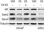 Targeting ADT-Induced Activation of the E3 Ubiquitin Ligase Siah2 to Delay the Occurrence of Castration-Resistant Prostate Cancer