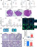 A missense in HSF2BP causing primary ovarian insufficiency affects meiotic recombination by its novel interactor - C19ORF57/BRME1 - eLife