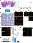 A missense in HSF2BP causing primary ovarian insufficiency affects meiotic recombination by its novel interactor - C19ORF57/BRME1 - eLife