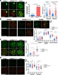 A missense in HSF2BP causing primary ovarian insufficiency affects meiotic recombination by its novel interactor - C19ORF57/BRME1 - eLife