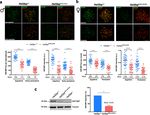 A missense in HSF2BP causing primary ovarian insufficiency affects meiotic recombination by its novel interactor - C19ORF57/BRME1 - eLife