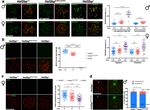 A missense in HSF2BP causing primary ovarian insufficiency affects meiotic recombination by its novel interactor - C19ORF57/BRME1 - eLife