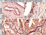 Melatonin administration provokes the activity of dendritic reticular cells in the seminal vesicle of Soay ram during the non breeding season - Nature