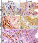 Melatonin administration provokes the activity of dendritic reticular cells in the seminal vesicle of Soay ram during the non breeding season - Nature