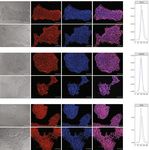 Downregulation of E cadherin in pluripotent stem cells triggers partial EMT