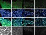 Downregulation of E cadherin in pluripotent stem cells triggers partial EMT