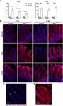 Constitutive Musashi1 expression impairs mouse postnatal development and intestinal homeostasis