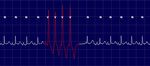 Ambulatory electrocardiography, heart rate variability, and pharmacologic stress testing in cats with subclinical hypertrophic cardiomyopathy - Nature