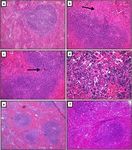 Pregabalin inhibits in vivo and in vitro cytokine secretion and attenuates spleen inflammation in Lipopolysaccharide/concanavalin A -induced ...