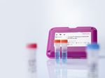 Love birds? Ensure early and accurate diagnosis of Avian Influenza A Virus infection - INDICAL Bioscience