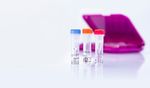 Love birds? Ensure early and accurate diagnosis of Avian Influenza A Virus infection - INDICAL Bioscience