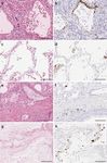 CHARACTERIZATION OF SARS-COV-2 AND HOST ENTRY FACTORS DISTRIBUTION IN A COVID-19 AUTOPSY SERIES - NATURE