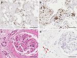 CHARACTERIZATION OF SARS-COV-2 AND HOST ENTRY FACTORS DISTRIBUTION IN A COVID-19 AUTOPSY SERIES - NATURE
