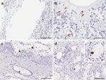 CHARACTERIZATION OF SARS-COV-2 AND HOST ENTRY FACTORS DISTRIBUTION IN A COVID-19 AUTOPSY SERIES - NATURE