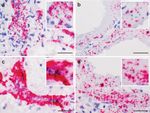 CHARACTERIZATION OF SARS-COV-2 AND HOST ENTRY FACTORS DISTRIBUTION IN A COVID-19 AUTOPSY SERIES - NATURE