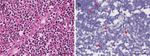 CHARACTERIZATION OF SARS-COV-2 AND HOST ENTRY FACTORS DISTRIBUTION IN A COVID-19 AUTOPSY SERIES - NATURE