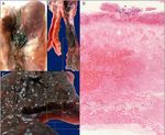 FLORIDA MEDICAL STUDENT RESEARCH JOURNAL - Herbert Wertheim ...