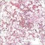 FLORIDA MEDICAL STUDENT RESEARCH JOURNAL - Herbert Wertheim ...