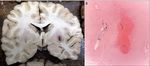 FLORIDA MEDICAL STUDENT RESEARCH JOURNAL - Herbert Wertheim ...