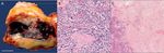 FLORIDA MEDICAL STUDENT RESEARCH JOURNAL - Herbert Wertheim ...