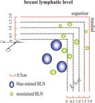 Minimize the extent and morbidity of axillary dissection for node-positive breast cancer patients: implementation of axillary lymph node ...