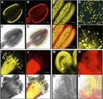 ECHIDNA Protein Impacts on Male Fertility in Arabidopsis by Mediating trans-Golgi Network Secretory Trafficking during Anther and Pollen ...