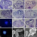 ECHIDNA Protein Impacts on Male Fertility in Arabidopsis by Mediating trans-Golgi Network Secretory Trafficking during Anther and Pollen ...