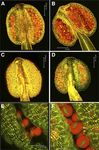 ECHIDNA Protein Impacts on Male Fertility in Arabidopsis by Mediating trans-Golgi Network Secretory Trafficking during Anther and Pollen ...